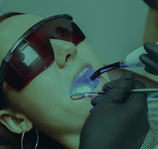 Clareamento Dental - Procedimento Odontológico