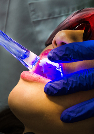 Clareamento Denta - Procedimento Odontológico