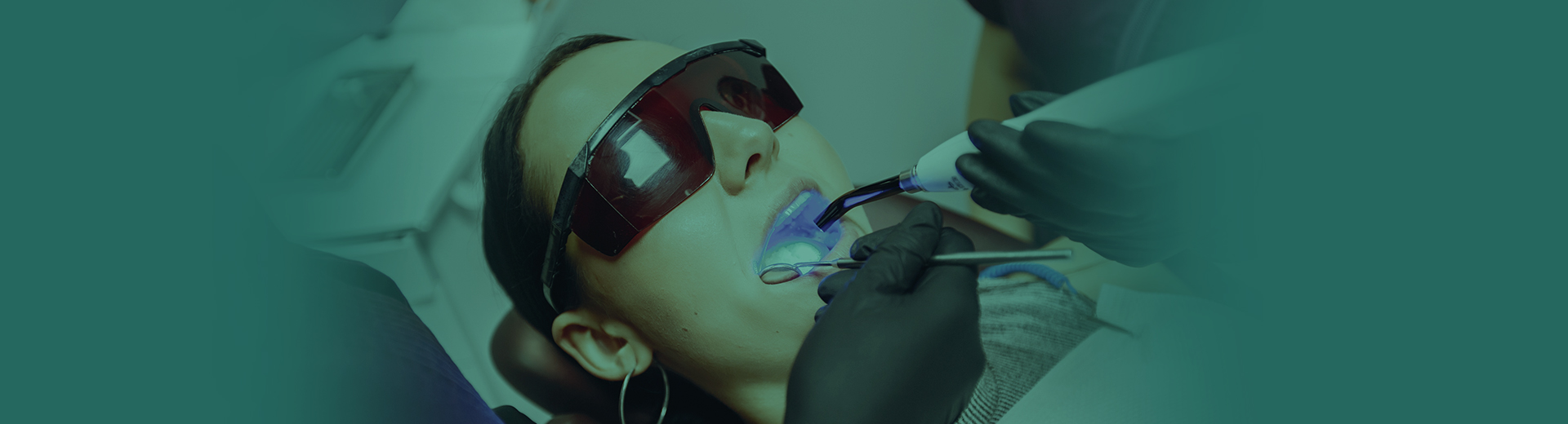 Clareamento Dental - Procedimento Odontológico